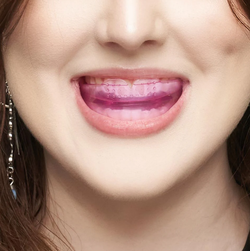 Ultimate Beauty Lip Assist